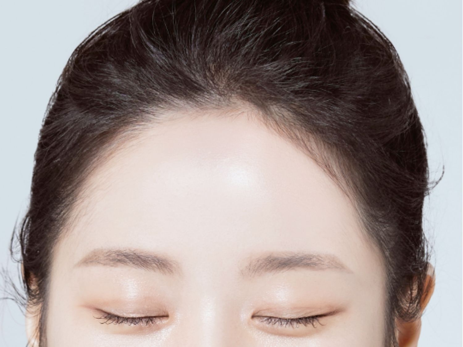 Tạo trán cân đối, trẻ trung