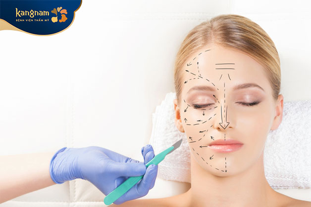 Phẫu thuật hạ gò má được đánh giá là an toàn