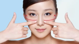 Hạ gò má không phẫu thuật: Bí quyết sở hữu khuôn mặt thon gọn V-line