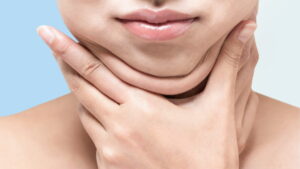 Hai cằm – ý nghĩa tướng số, nguyên nhân và cách khắc phục