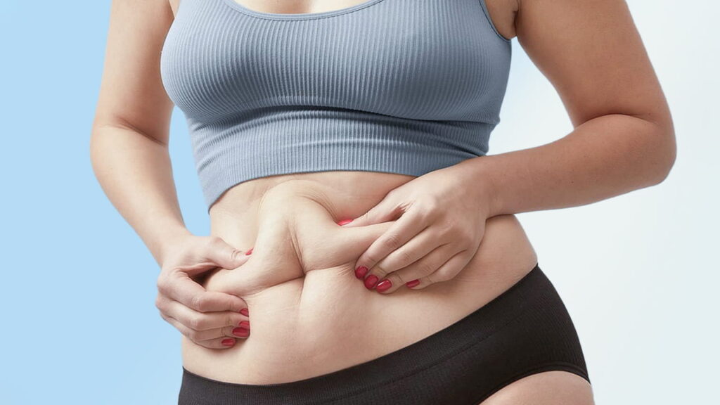 Hút mỡ bụng có nguy hiểm không – Tất cả những gì bạn cần biết