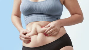 Hút mỡ bụng có nguy hiểm không - Tất cả những gì bạn cần biết