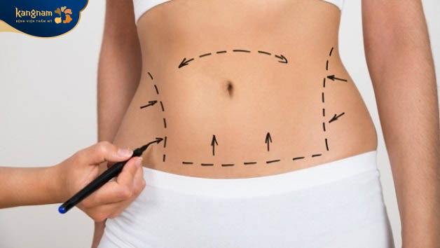 Khách hàng nên chú ý kiêng quan hệ khoảng 4- 6 tuần sau khi hút mỡ