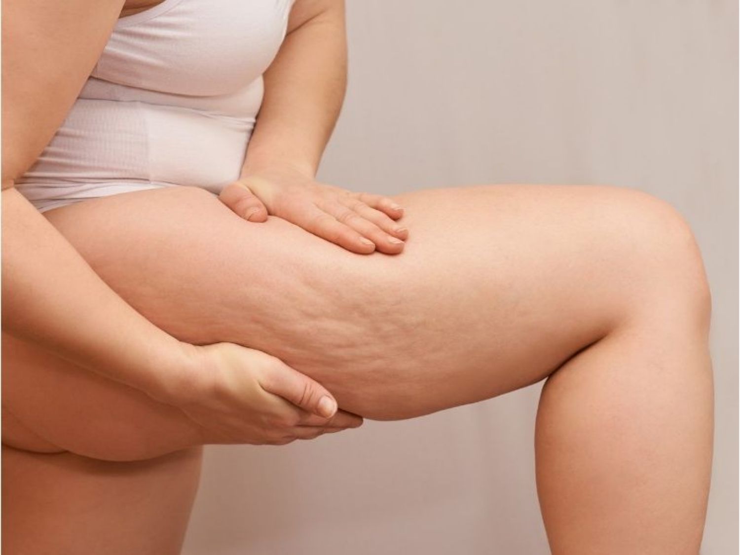 tình trạng mỡ Đùi trong chảy xệ nên cân nhắc hút mỡ để triệt tiêu