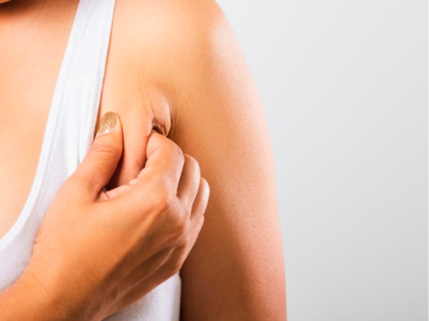 Mỡ nách do thừa cân