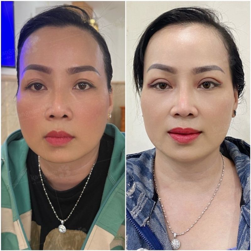 Mát 2 mí sắc nét, nếp mí đều