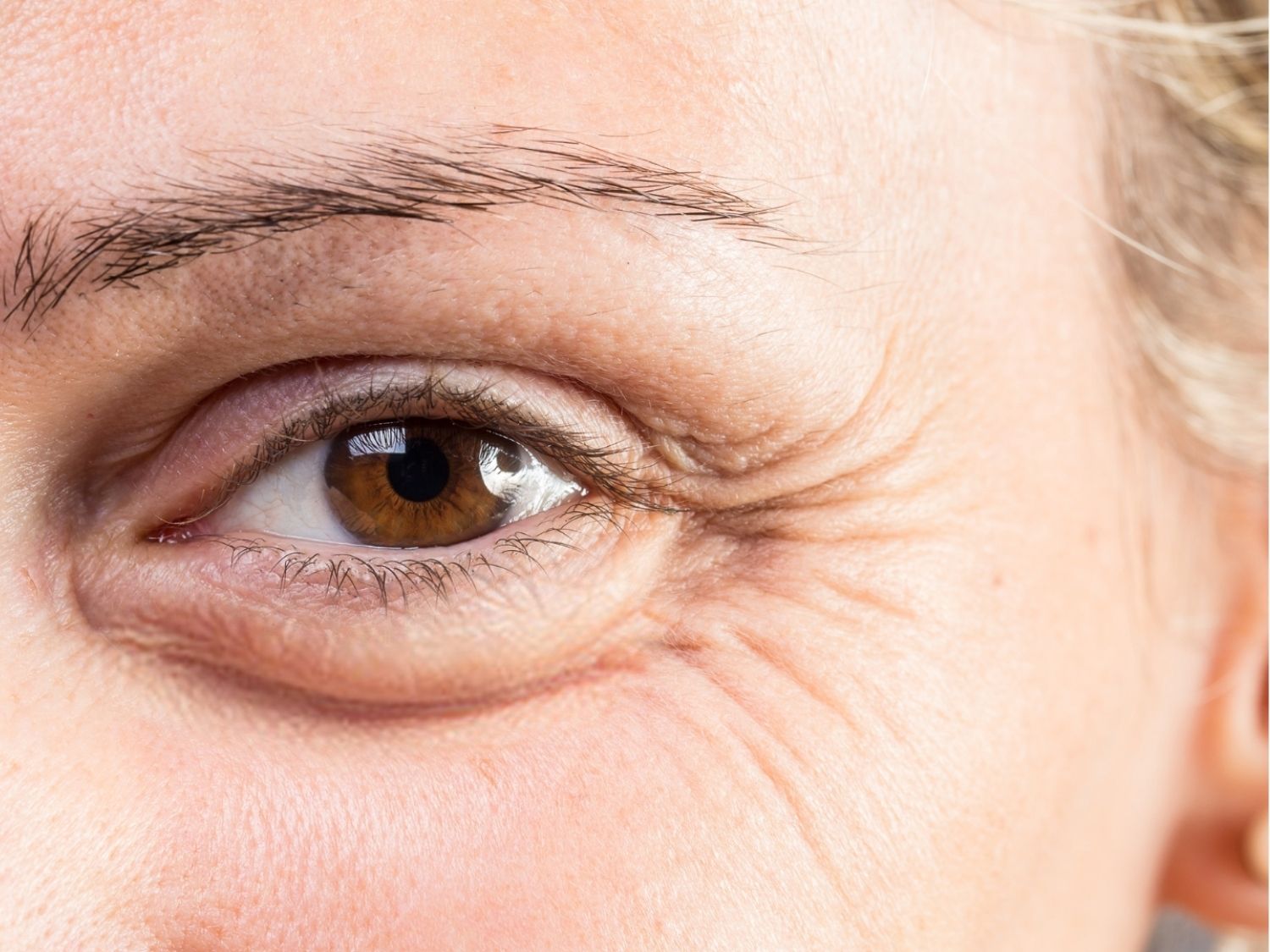 Vùng da dưới mắt theo thời gian sẽ mất đi độ đàn hồi và collagen