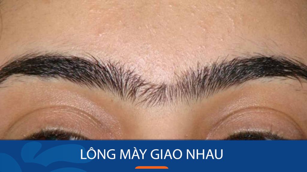 Lông mày giao nhau: Ý nghĩa, vận mệnh và cách cải thiện cho vẻ ngoài hoàn hảo