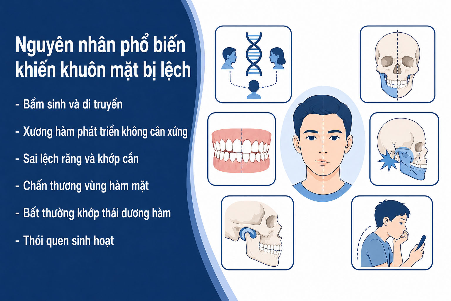 ảnh mô tả Nguyên nhân phổ biến khiến khuôn mặt bị lệch