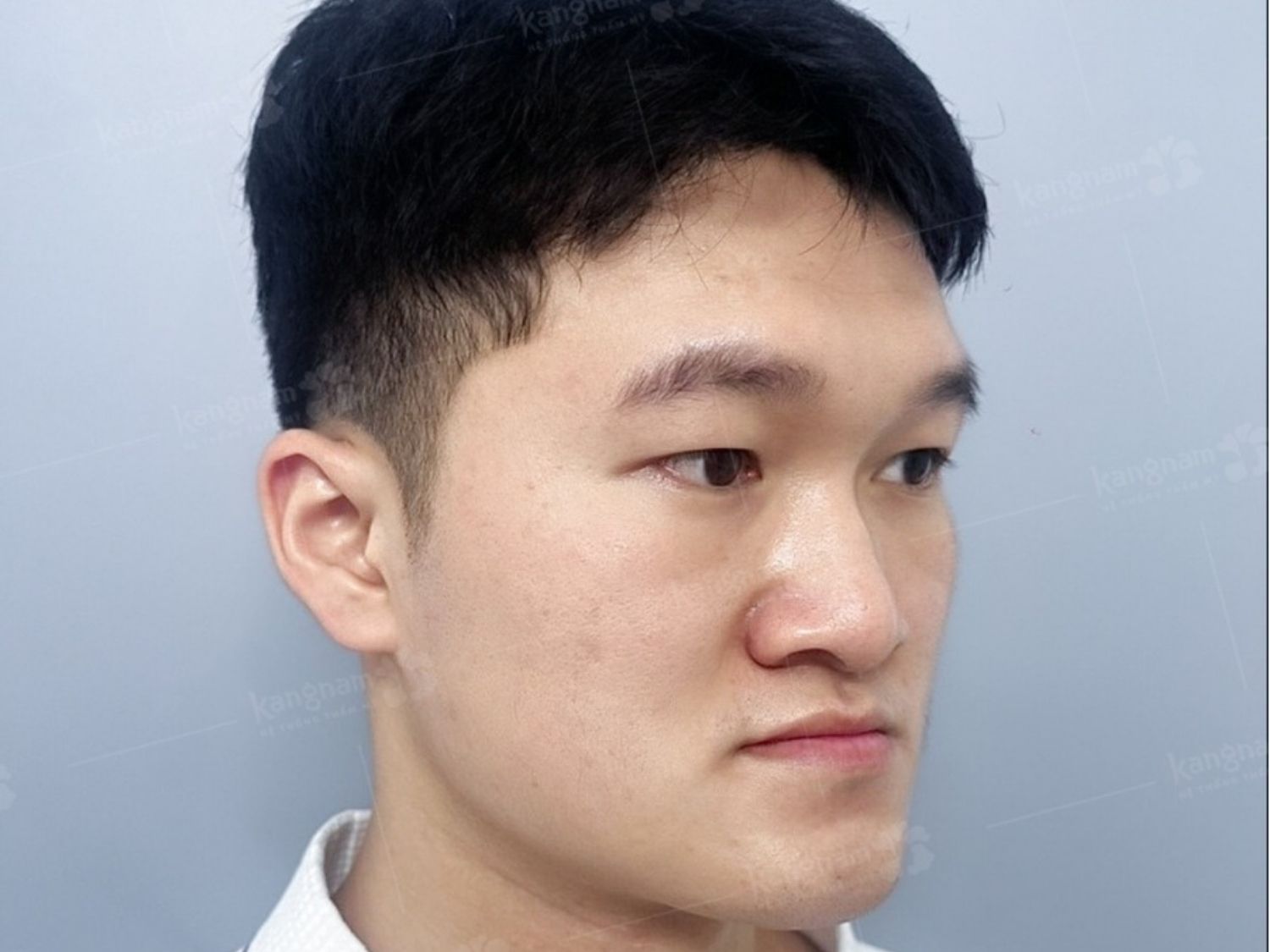 Tướng mặt lưỡi cày nam