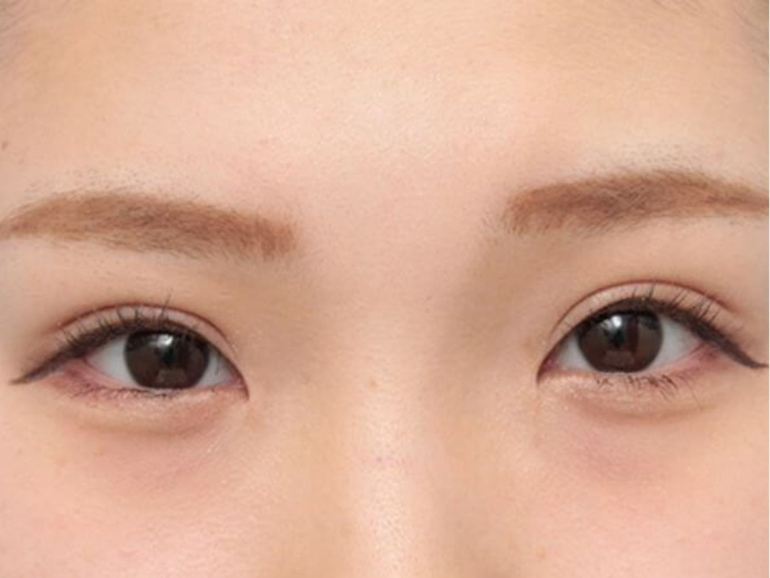 Gen di truyền cũng quyết định hình dáng mắt