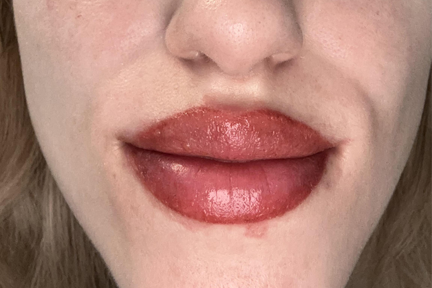 Môi bị lộ viền, lem viền