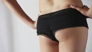 Mông lép có cải thiện được không? Giải pháp nâng vòng 3 an toàn, hiệu quả