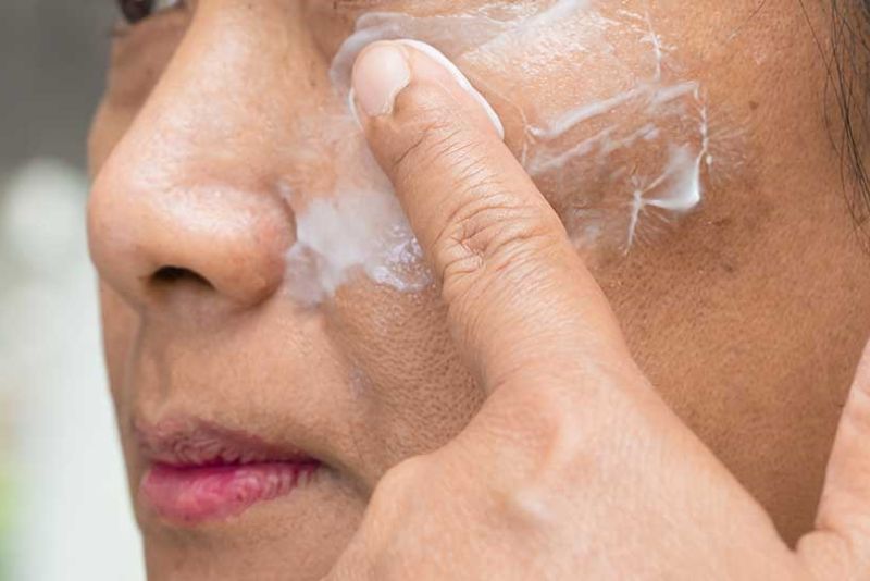 Dùng mỹ phẩm sai cách gây mụn ẩn