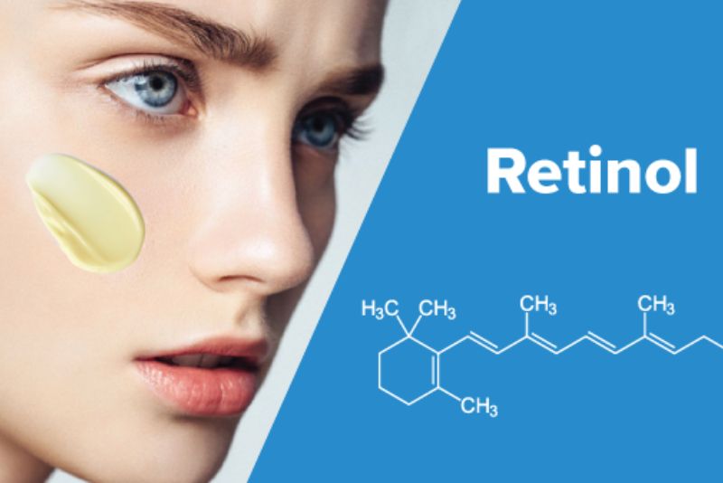Sử dụng BHA hoặc retinoids là giải pháp hỗ trợ điều trị mụn đầu đen hiệu quả
