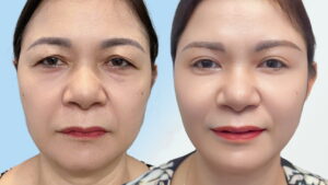 Nâng Mày Có Ảnh Hưởng Tướng Số? Bí Mật Tạo Vẻ Đẹp Hài Hòa & May Mắn