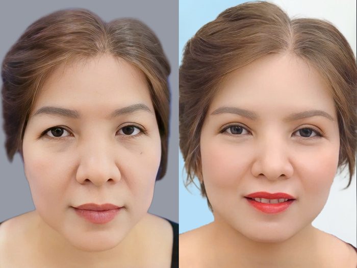 Gương mặt tươi tắn hơn sau khi nâng cung mày