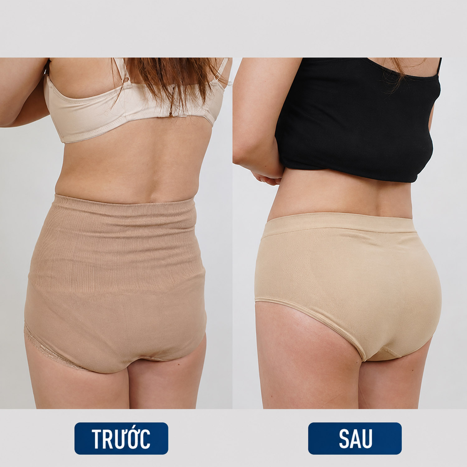 ảnh trước sau của khách hàng nâng mông tại Kangnam, mông căng tròn quyến rũ
