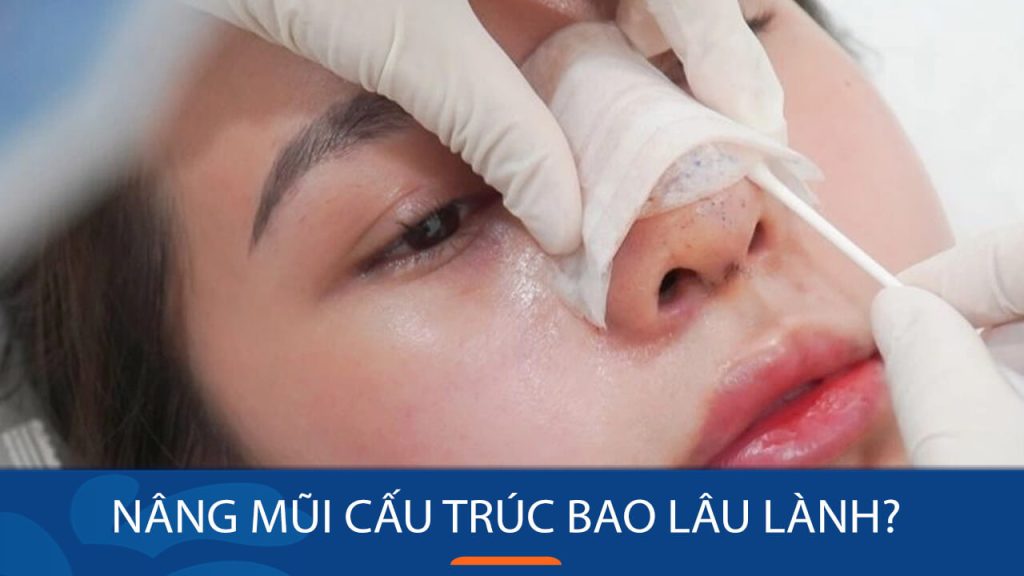 Nâng mũi cấu trúc bao lâu thì lành? Thời gian hồi phục và những lưu ý cần biết