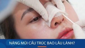 Nâng mũi cấu trúc bao lâu thì lành? Thời gian hồi phục và những lưu ý cần biết