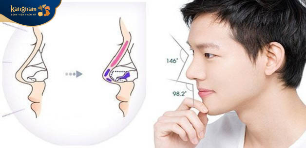 Một dáng mũi đẹp phải đạt chuẩn tỷ lệ vàng và hài hòa với gương mặt