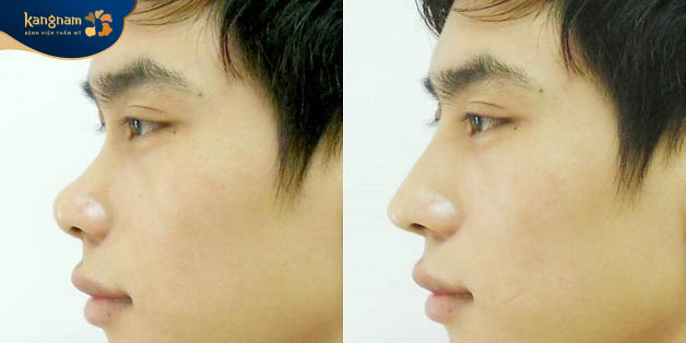 Tiêu chuẩn thẩm mỹ giữa nam và nữ giới khác nhau