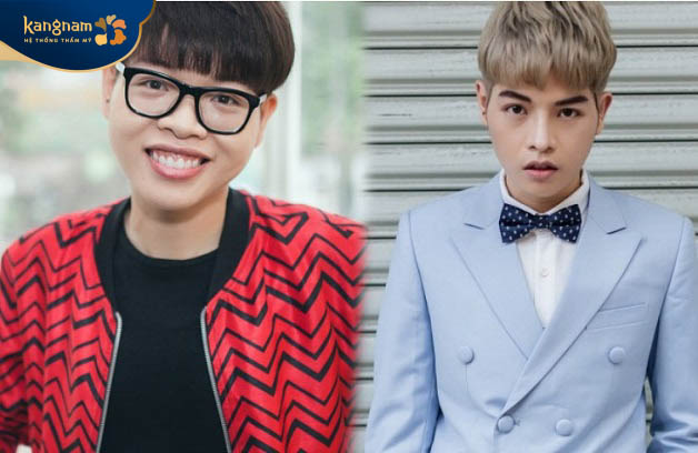 Nam giới nên nâng mũi khi dáng mũi nhiều khuyết điểm, chưa ưng ý