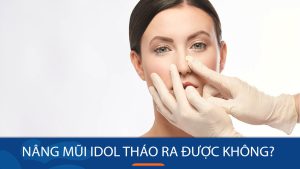 Nâng mũi Idol có tháo ra được không? Giải đáp thắc mắc từ chuyên gia