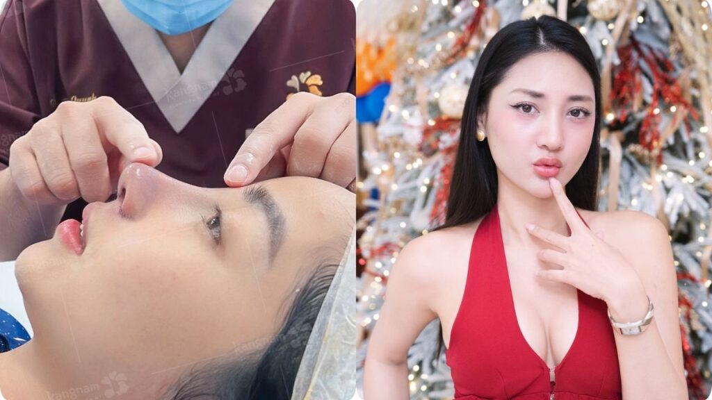 Nâng mũi phong thủy là gì? Có thật sự ảnh hưởng vận mệnh không?