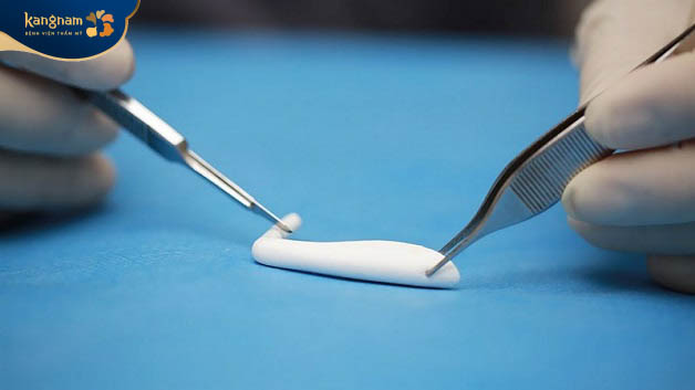 Sụn Nanoform là loại sụn cao cấp được làm từ ePTFE