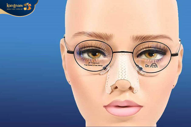 Nên đợi sau 1 tháng nâng mũi mới lên đeo kính