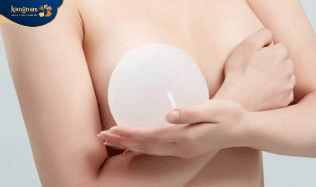 Cần chỉnh sửa thay thế túi độn ngực