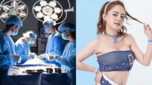 Nâng ngực tại Hà Nội ở đâu uy tín? Top Bệnh viện và Bác sĩ chuyên khoa giỏi 2026