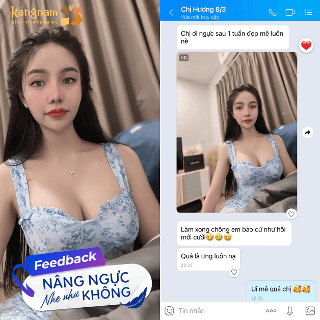 Feedback đáng yêu của Thu Hương sau Nâng ngực “Nhẹ như không”
