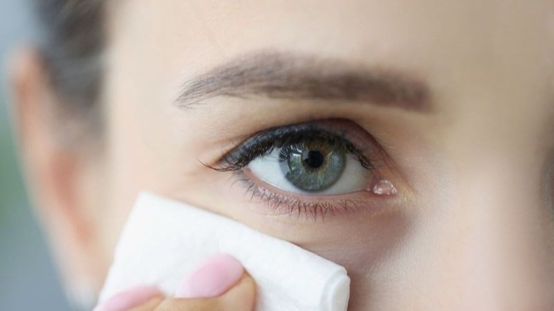 Vệ sinh vùng mí mắt sạch sẽ