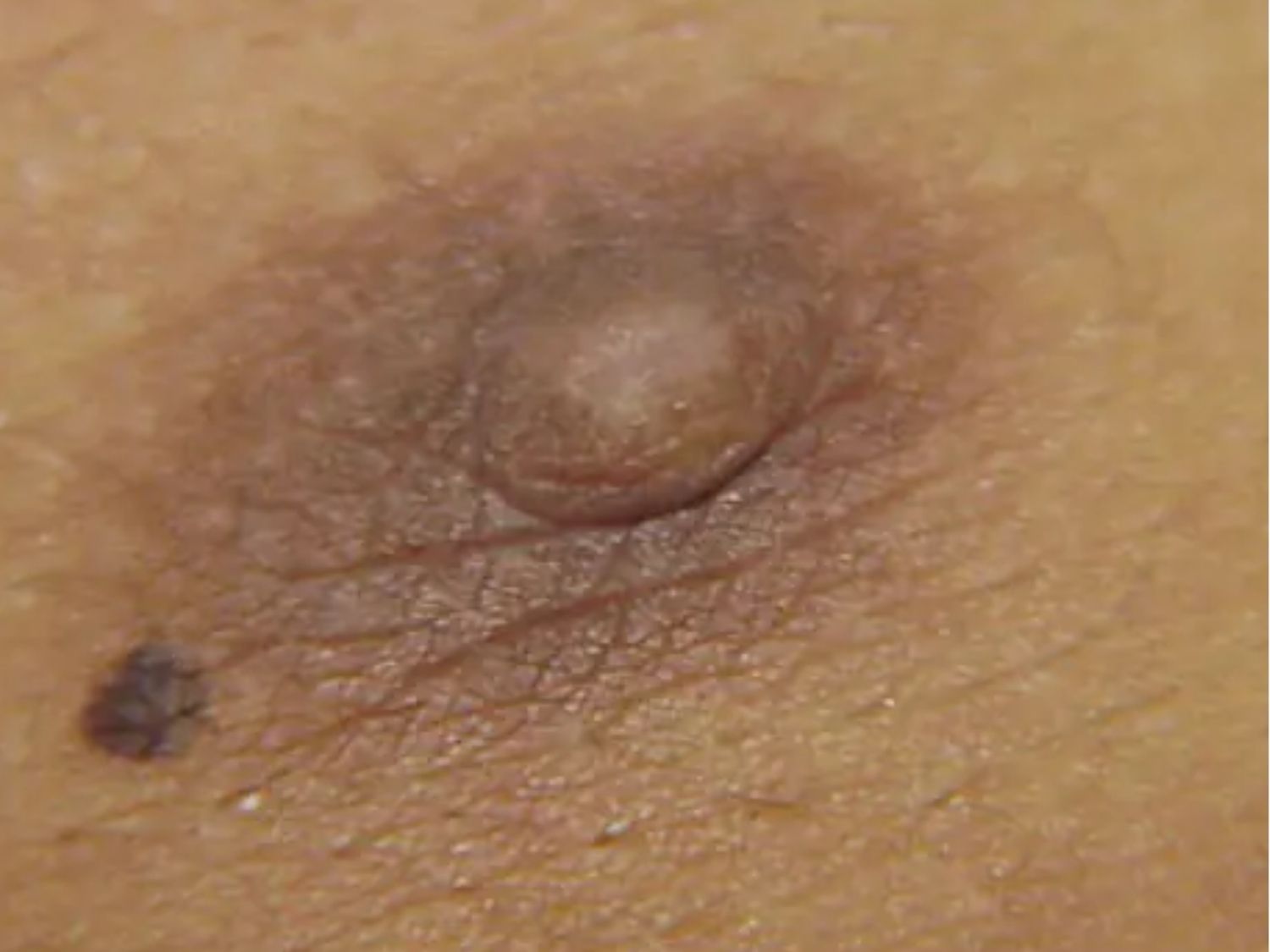 Tuổi tác làm nhũ hoa sẫm màu