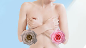 Nhũ hoa thâm đen: Đừng lo lắng, đã có cách cải thiện!