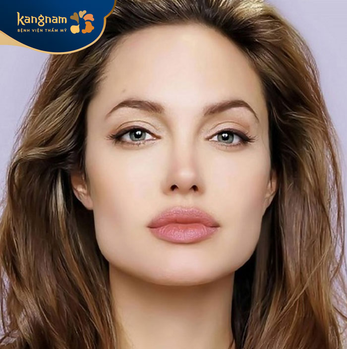 Gò má thấp sẽ khiến khuôn mặt trông lõm xuống, thiếu cân đối