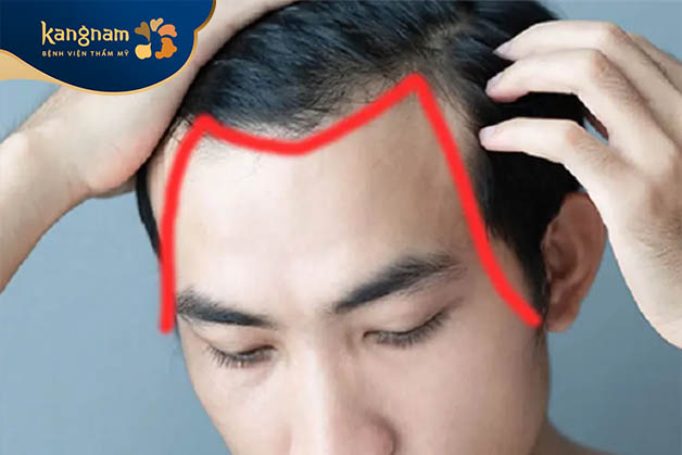 Trong Phật giáo, trán chữ M được xem là dấu hiệu của sự may mắn