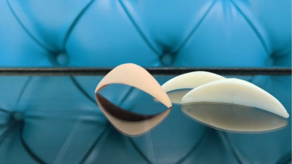 2 Loại sụn độn cằm phổ biến: So sánh ưu/nhược điểm để lựa chọn tốt nhất