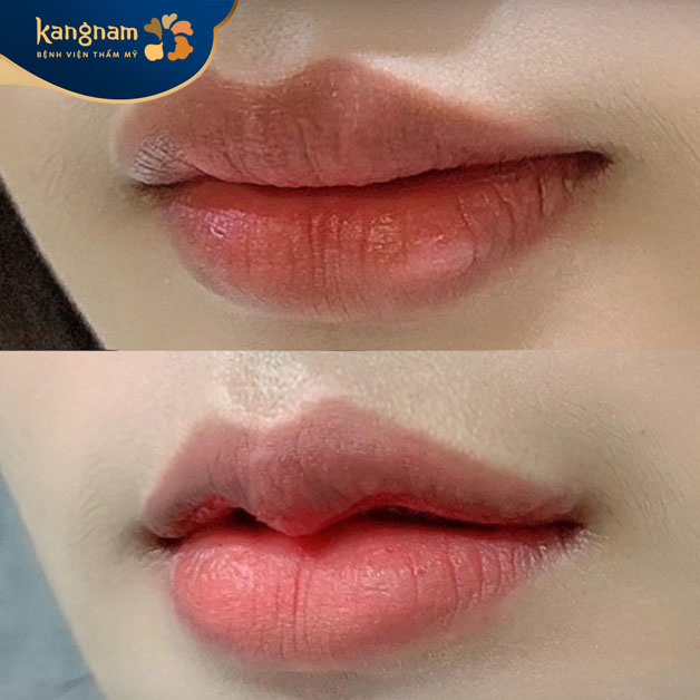 Môi cong mềm mại và thu hút