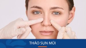 Tháo sụn mũi khi nào cần? 6 dấu hiệu, quy trình và chăm sóc sau tháo