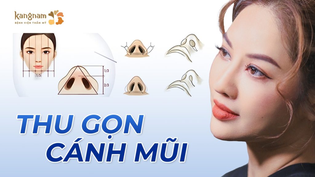 Thu gọn cánh mũi là gì? Khi nào nên thực hiện và những điều cần biết