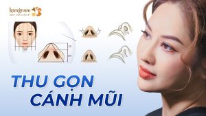 Thu gọn cánh mũi tự nhiên