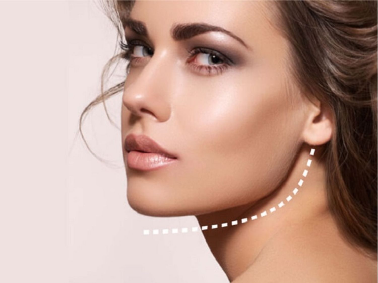 Người có cơ hàm phát triển quá mức có thể cân nhắc tiêm botox