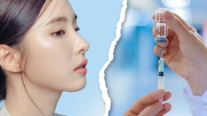 Tiêm cằm bao nhiêu cc là đẹp? Giải đáp thắc mắc từ chuyên gia