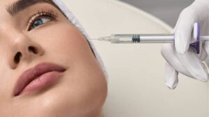 Tiêm Botox Hạ Gò Má: Những Điều Cần Biết Trước Khi Thực Hiện