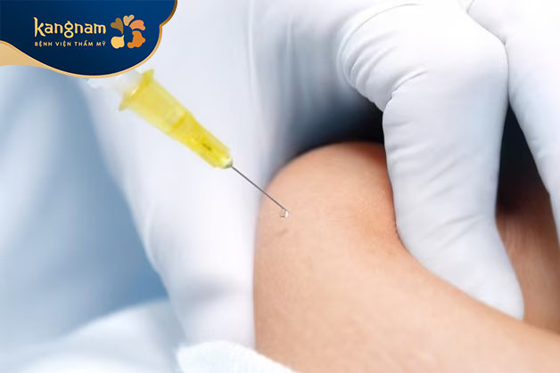 Thủ thuật tiêm làm gọn bắp tay sử dụng kim tiêm chuyên dụng