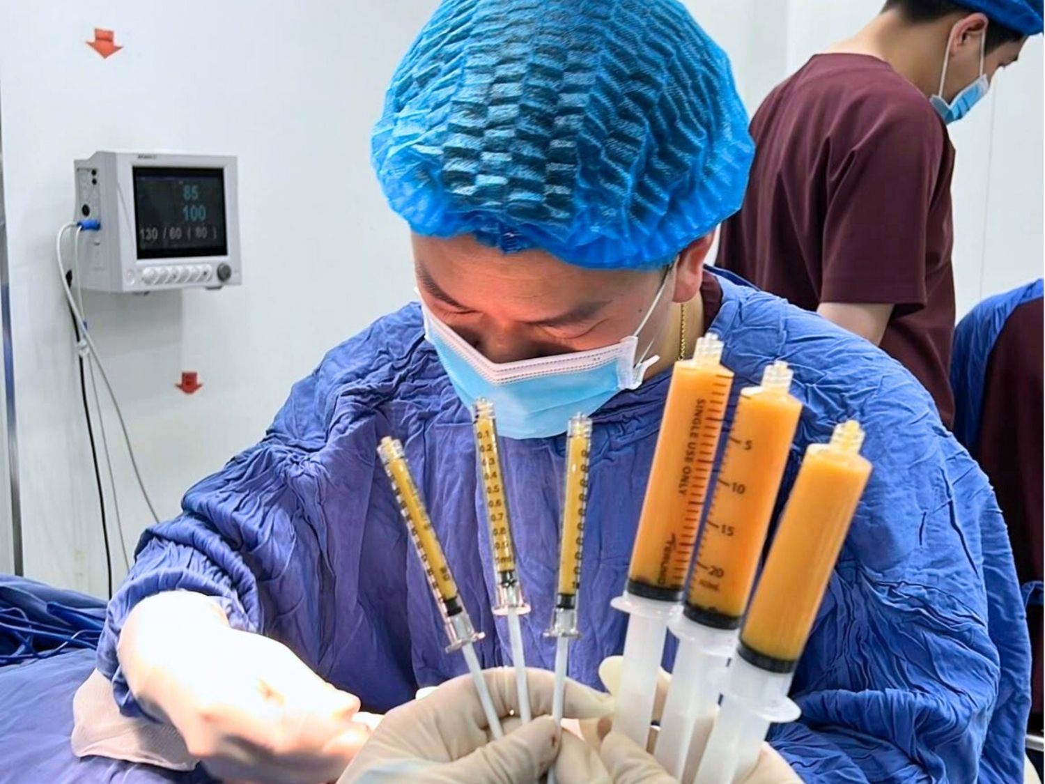 Khách hàng cấy mỡ tự thân