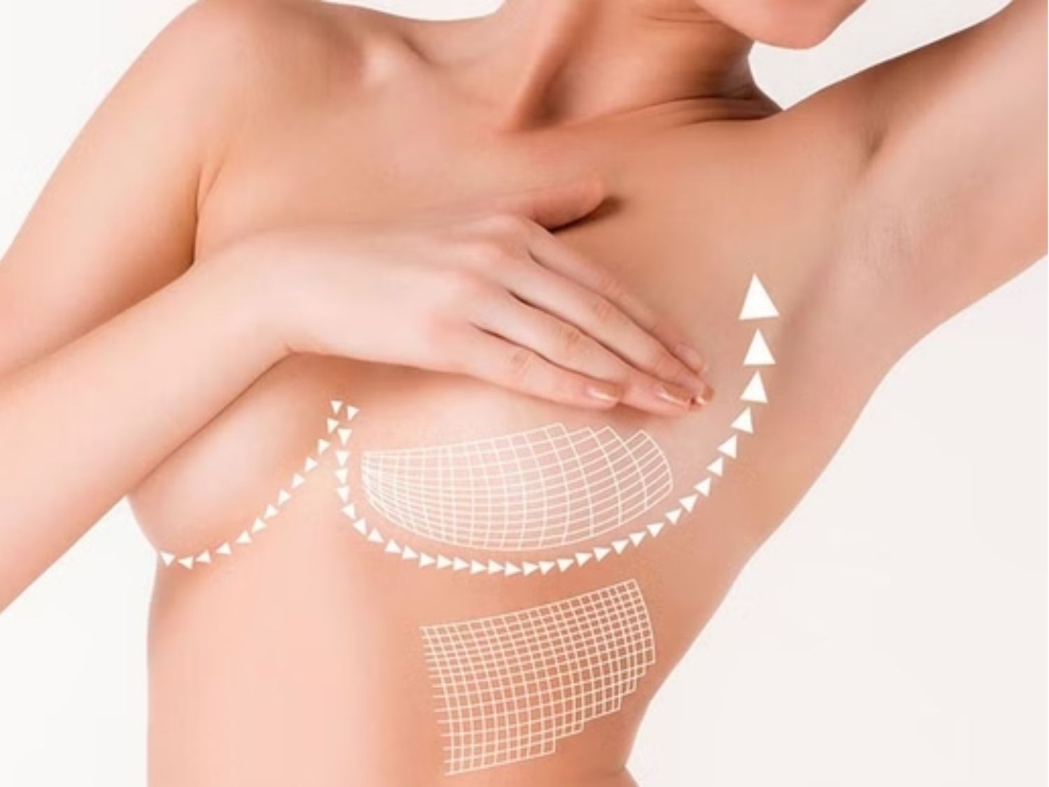 Treo sa trễ không đặt túi bằng chỉ